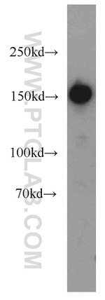 SAFB Antibody in Western Blot (WB)