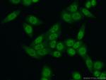 TCERG1 Antibody in Immunocytochemistry (ICC/IF)