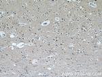 TCERG1 Antibody in Immunohistochemistry (Paraffin) (IHC (P))