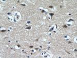 TCERG1 Antibody in Immunohistochemistry (Paraffin) (IHC (P))