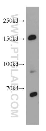 TCERG1 Antibody in Western Blot (WB)