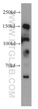 TCERG1 Antibody in Western Blot (WB)