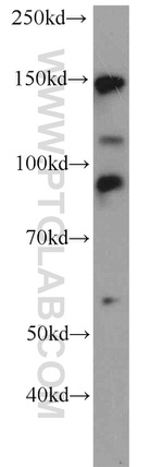 TCERG1 Antibody in Western Blot (WB)
