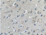 PCDH10 Antibody in Immunohistochemistry (Paraffin) (IHC (P))