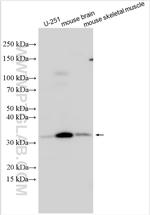 TIGD7 Antibody in Western Blot (WB)