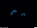 CCHCR1 Antibody in Immunocytochemistry (ICC/IF)