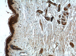 CCHCR1 Antibody in Immunohistochemistry (Paraffin) (IHC (P))