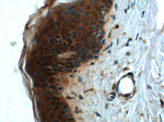 CCHCR1 Antibody in Immunohistochemistry (Paraffin) (IHC (P))