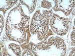 CCHCR1 Antibody in Immunohistochemistry (Paraffin) (IHC (P))
