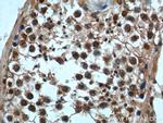 CCHCR1 Antibody in Immunohistochemistry (Paraffin) (IHC (P))