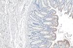 CCHCR1 Antibody in Immunohistochemistry (Paraffin) (IHC (P))
