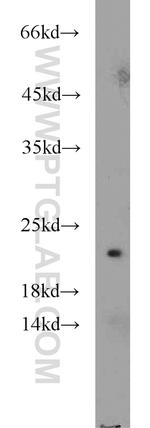 DUS4L Antibody in Western Blot (WB)