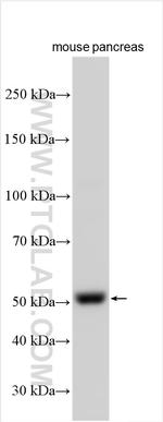 SLC38A9 Antibody in Western Blot (WB)