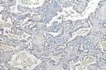 DSG2 Antibody in Immunohistochemistry (Paraffin) (IHC (P))