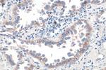 DSG2 Antibody in Immunohistochemistry (Paraffin) (IHC (P))
