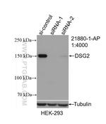 DSG2 Antibody in Western Blot (WB)