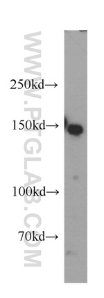 DSG2 Antibody in Western Blot (WB)