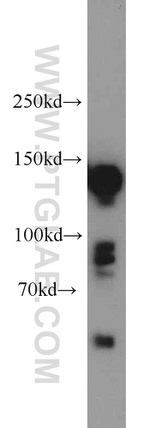 DSG2 Antibody in Western Blot (WB)