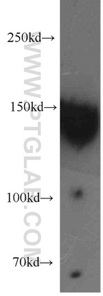 DSG2 Antibody in Western Blot (WB)