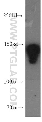 DSG2 Antibody in Western Blot (WB)