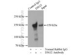DSG2 Antibody in Immunoprecipitation (IP)