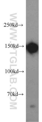 DSG2 Antibody in Western Blot (WB)
