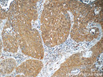 PI3K p110(alpha) Antibody in Immunohistochemistry (Paraffin) (IHC (P))