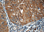 PI3K p110(alpha) Antibody in Immunohistochemistry (Paraffin) (IHC (P))