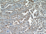 PI3K p110(alpha) Antibody in Immunohistochemistry (Paraffin) (IHC (P))