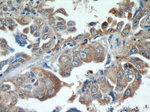 PI3K p110(alpha) Antibody in Immunohistochemistry (Paraffin) (IHC (P))