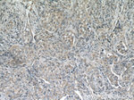 PI3K p110(alpha) Antibody in Immunohistochemistry (Paraffin) (IHC (P))