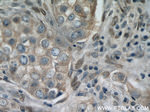 PI3K p110(alpha) Antibody in Immunohistochemistry (Paraffin) (IHC (P))