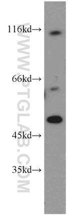 PI3K p110(alpha) Antibody in Western Blot (WB)