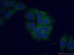 PI3K p110(alpha) Antibody in Immunocytochemistry (ICC/IF)