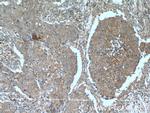 PI3K p110(alpha) Antibody in Immunohistochemistry (Paraffin) (IHC (P))