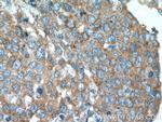 PI3K p110(alpha) Antibody in Immunohistochemistry (Paraffin) (IHC (P))