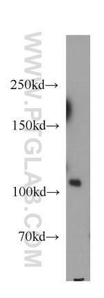 PI3K p110(alpha) Antibody in Western Blot (WB)