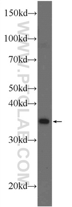 THAP10 Antibody in Western Blot (WB)