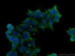 TGF-beta 1 Antibody in Immunocytochemistry (ICC/IF)