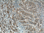 TGF-beta 1 Antibody in Immunohistochemistry (Paraffin) (IHC (P))