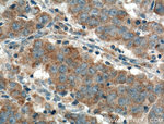 TGF-beta 1 Antibody in Immunohistochemistry (Paraffin) (IHC (P))