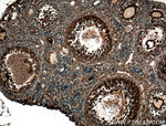 TGF-beta 1 Antibody in Immunohistochemistry (Paraffin) (IHC (P))