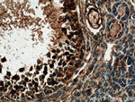 TGF-beta 1 Antibody in Immunohistochemistry (Paraffin) (IHC (P))