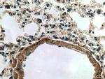 TGF-beta 1 Antibody in Immunohistochemistry (Paraffin) (IHC (P))