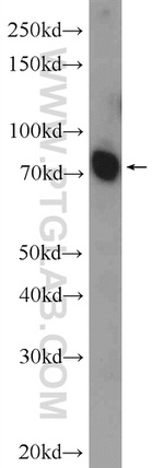 ANO10 Antibody in Western Blot (WB)
