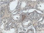 ANO10 Antibody in Immunohistochemistry (Paraffin) (IHC (P))