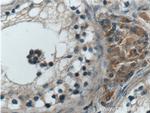 ANO10 Antibody in Immunohistochemistry (Paraffin) (IHC (P))