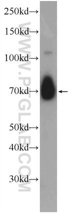 ANO10 Antibody in Western Blot (WB)