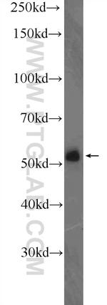 KIAA0141 Antibody in Western Blot (WB)