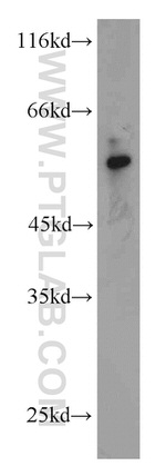 KIAA0141 Antibody in Western Blot (WB)